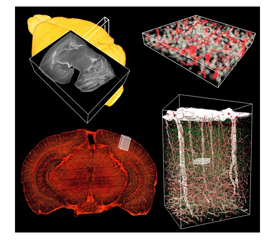 哺乳动物全脑范围同时实现细胞和血管真实精细构筑的可视化与定量分析